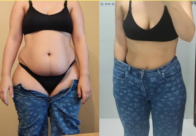 após uma gravidez 💜