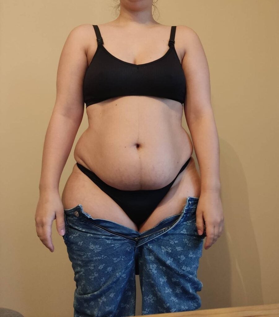 após uma gravidez o antes